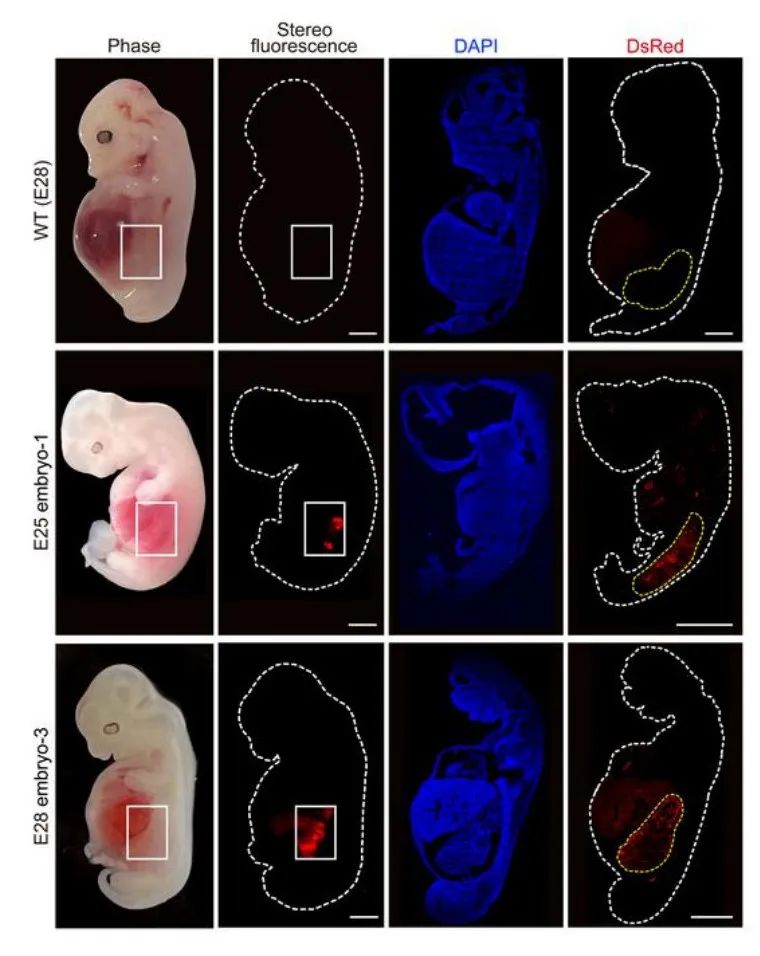 cancercells_memorytcells_cells
