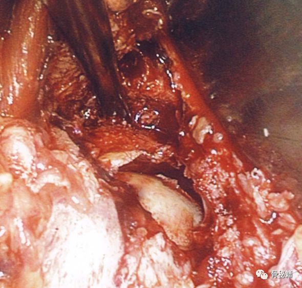 臼怎么读_臼_臼的拼音