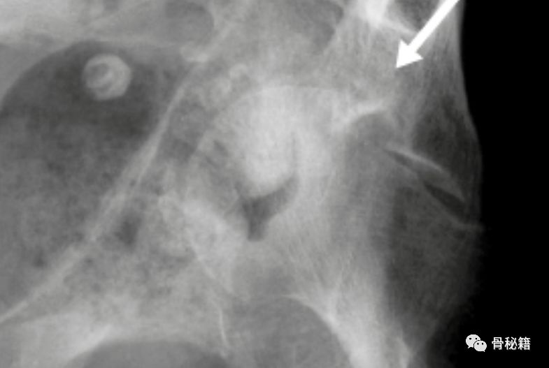 臼怎么读_臼的拼音_臼