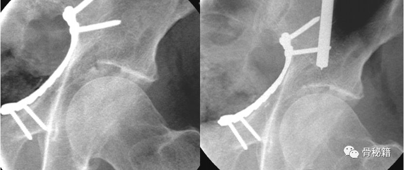 臼_臼怎么读_臼的拼音