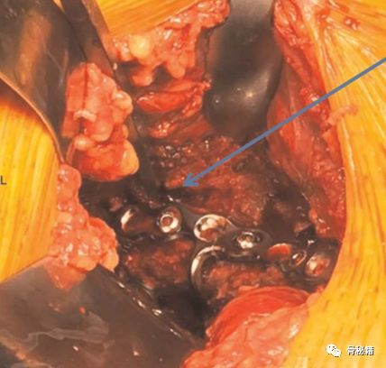 臼怎么读_臼_臼的拼音