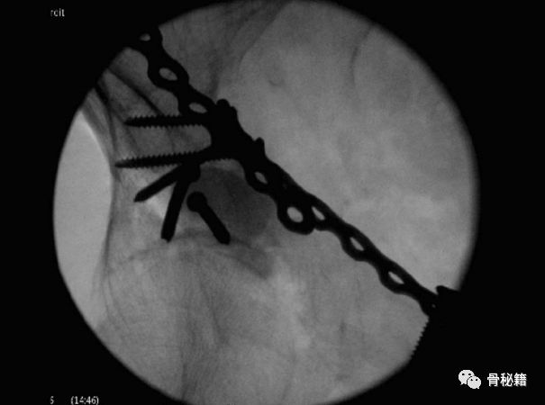 臼的拼音_臼_臼怎么读