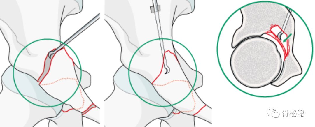 臼怎么读_臼_臼的拼音