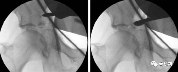 臼_臼的拼音_臼怎么读