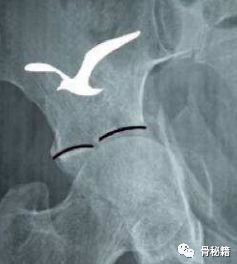 臼的拼音_臼怎么读_臼