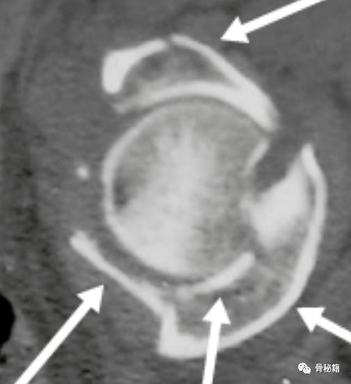 臼的拼音_臼_臼怎么读