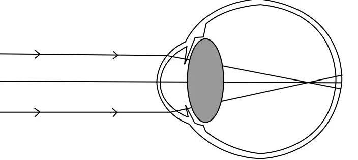 防蓝光眼镜有什么好处_防蓝光眼镜有什么好处_防蓝光眼镜有什么好处